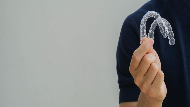 aligners singapore